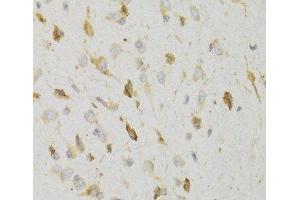 Immunohistochemistry of paraffin-embedded Rat brain using KISS1R Polyclonal Antibody at dilution of 1:100 (40x lens). (KISS1R anticorps)