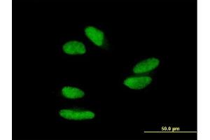 Immunofluorescence of purified MaxPab antibody to ZNF398 on HepG2 cell. (ZNF398 anticorps  (AA 1-642))