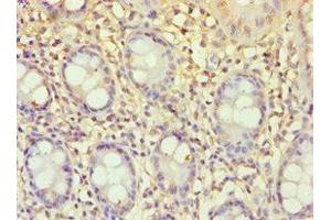 Immunohistochemistry of paraffin-embedded human colon tissue using ABIN7151765 at dilution of 1:100 (ECE2 anticorps  (AA 1-160))