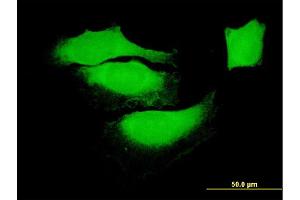Immunofluorescence of monoclonal antibody to BAG1 on HeLa cell. (BAG1 anticorps  (AA 241-345))
