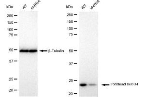 Western blotting analysis using Forkhead box O4 antibody (ABIN7798648).