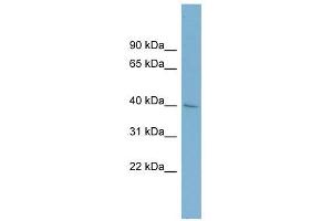 A4GALT antibody used at 1 ug/ml to detect target protein. (A4GALT anticorps)