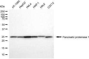Western blotting analysis using pancreatic proteinase 1 antibody (ABIN7799732). (Recombinant Pancreatic Proteinase 1 (PRT1) anticorps)