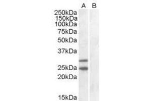 Image no. 2 for anti-Suppressor of Cytokine Signaling 1 (SOCS1) (C-Term) antibody (ABIN374072) (SOCS1 anticorps  (C-Term))