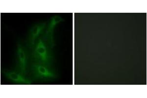 Immunofluorescence analysis of HeLa cells, using Collagen IV alpha6 Antibody. (COL4a6 anticorps  (AA 1201-1250))