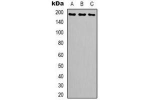 Western blot analysis of Topoisomerase 2 alpha expression in Hela (A), Jurkat (B), mouse brain (C) whole cell lysates.