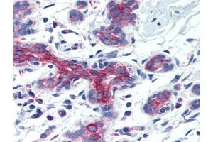 Human Breast (formalin-fixed, paraffin-embedded) stained with AIFM3at 5 µg/ml followed by biotinylated goat anti-rabbit IgG secondary antibody, alkaline phosphatase-streptavidin and chromogen. (AIFM3 anticorps  (Center))