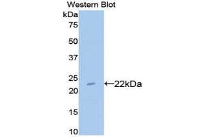 Western Blotting (WB) image for anti-Bleomycin Hydrolase (BLMH) (AA 30-165) antibody (ABIN3201698) (BLMH anticorps  (AA 30-165))