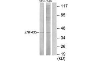 Western Blotting (WB) image for anti-Zinc Finger and SCAN Domain Containing 16 (ZSCAN16) (AA 191-240) antibody (ABIN2889761) (ZSCAN16 anticorps  (AA 191-240))