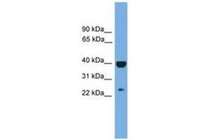 Image no. 1 for anti-Suppressor of Cytokine Signaling 1 (SOCS1) (AA 107-156) antibody (ABIN6744715) (SOCS1 anticorps  (AA 107-156))