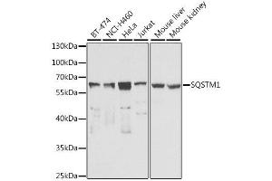 Western blot analysis of extracts of various cell lines, using SQSTM1 antibody.