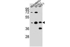 Western blot analysis of hCG_1645727 Antibody (C-term) in MDA-MB453,ZR-75-1,MCF-7 cell line lysates (35ug/lane). (KBTBD13 anticorps  (C-Term))