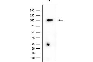 anti-Cadherin 26 (CDH26) (N-Term) antibody