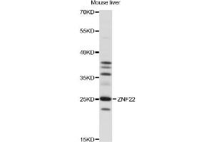 Western blot analysis of extracts of mouse liver, using ZNF22 antibody (ABIN6291375) at 1:1000 dilution. (Zinc Finger Protein 22 anticorps)