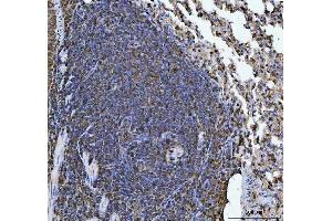 IHC analysis of ERP29 using anti-ERP29 antibody (ABIN7601342).