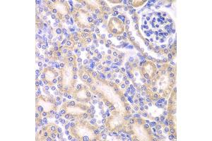 Immunohistochemistry of paraffin-embedded rat kidney using AK4 antibody (ABIN5971082) at dilution of 1/200 (40x lens). (AK4 anticorps)