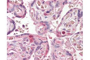 Anti-FANCE antibody IHC of human placenta. (FANCE anticorps  (AA 235-247))