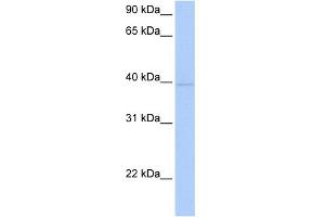 WB Suggested Anti-ZNF385D Antibody Titration:  0. (ZNF385D anticorps  (C-Term))