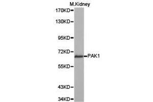 Western Blotting (WB) image for anti-P21-Activated Kinase 1 (PAK1) antibody (ABIN1874025) (PAK1 anticorps)