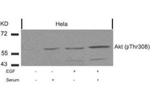 Image no. 2 for anti-V-Akt Murine Thymoma Viral Oncogene Homolog 1 (AKT1) (pThr308) antibody (ABIN196710) (AKT1 anticorps  (pThr308))
