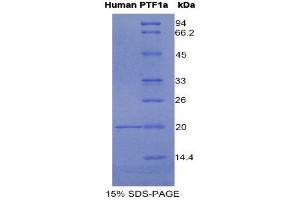 SDS-PAGE (SDS) image for Pancreas Specific Transcription Factor, 1a (PTF1A) (AA 177-328) protein (His tag) (ABIN1080445)