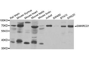 Western blot analysis of extracts of various cell lines, using SMARCD1 antibody (ABIN5973730) at 1/1000 dilution. (SMARCD1 anticorps)