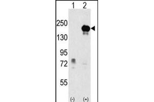 Western blot analysis of EHMT1 (arrow) using rabbit polyclonal EHMT1 Antibody (Center) (ABIN387856 and ABIN2844018).