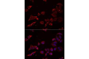 Immunofluorescence analysis of U2OS cell using NRBF2 antibody. (NRBF2 anticorps)