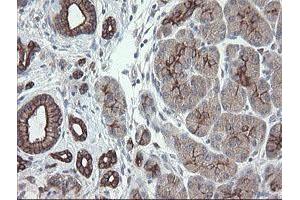 Image no. 9 for anti-Prefoldin Subunit 3 (PFDN3) antibody (ABIN1501702)