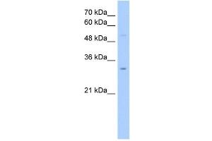NSUN5C antibody used at 2. (NSUN5P2 anticorps  (Middle Region))