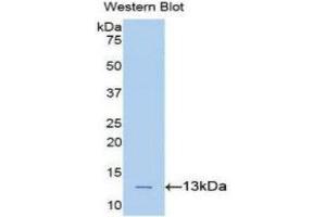 Western Blotting (WB) image for anti-Phospholipase A2-Activating Protein (PLAA) (AA 367-468) antibody (ABIN1860253) (PLAA anticorps  (AA 367-468))