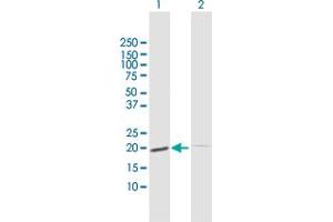Western Blot analysis of ESM1 expression in transfected 293T cell line by ESM1 MaxPab polyclonal antibody. (ESM1 anticorps  (AA 1-184))