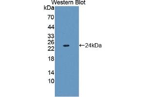 Detection of Recombinant FTL, Human using Polyclonal Antibody to Ferritin, Light Polypeptide (FTL)