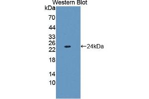 Detection of Recombinant FTL, Human using Polyclonal Antibody to Ferritin, Light Polypeptide (FTL) (FTL anticorps  (AA 2-175))