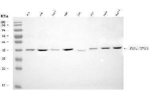 Western blot analysis of RRS1 using anti-RRS1 antibody (ABIN7602918).