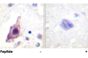 Immunohistochemical analysis of paraffin-embedded human brain tissue using CDC25B polyclonal antibody . (CDC25B anticorps)