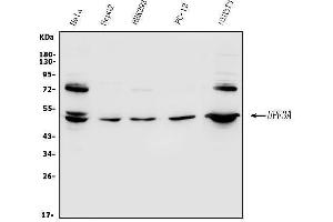 Western blot analysis of UPF3A using anti-UPF3A antibody (ABIN7601625).