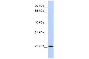 WB Suggested Anti-SSX5 Antibody Titration:  0. (SSX5 anticorps  (N-Term))