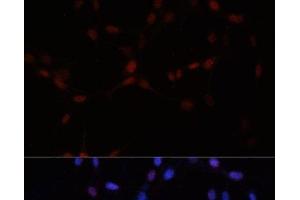 Immunofluorescence analysis of NIH-3T3 cells using SUMO1 Polyclonal Antibody at dilution of 1:100. (SUMO1 anticorps)