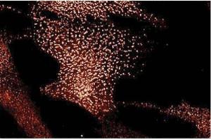 Immunofluorescence staining of Human Fibroblast cells.