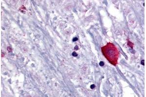 anti-Bombesin-Like Receptor 3 (BRS3) (N-Term) antibody