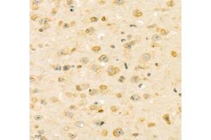 Immunohistochemistry of paraffin embedded mouse brain using Adenosine kinase (ABIN7072953) at dilution of 1: 300 (400x lens)