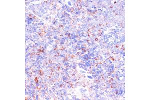 Immunohistochemistry of paraffin-embedded Mouse spleen using CD18 antibody (ABIN3023117, ABIN3023118, ABIN3023119 and ABIN6219398) at dilution of 1:100 (40x lens).