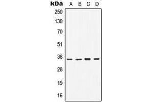 Western blot analysis of CD1b expression in H1299 (A), Jurkat (B), Raw264. (CD1b anticorps  (Center))