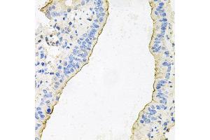Immunohistochemistry of paraffin-embedded mouse lung using HPR antibody at dilution of 1:100 (x40 lens). (HPR anticorps)