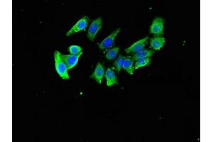 Immunofluorescent analysis of PC-3 cells using ABIN7149804 at dilution of 1:100 and Alexa Fluor 488-congugated AffiniPure Goat Anti-Rabbit IgG(H+L)