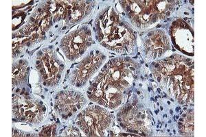 Image no. 6 for anti-V-Akt Murine Thymoma Viral Oncogene Homolog 1 (AKT1) antibody (ABIN1496557) (AKT1 anticorps)