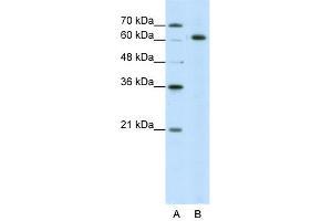 WB Suggested Anti-SNRP70 Antibody Titration:  5. (SNRNP70 anticorps  (N-Term))