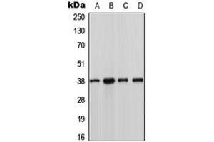 Western blot analysis of CK1 alpha expression in MCF7 (A), Jurkat (B), NIH3T3 (C), H9C2 (D) whole cell lysates.