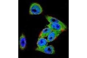 Confocal immunofluorescent analysis of Dishevelled-3 / DVL3 Antibody (C-term) Cat.